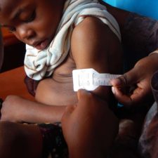 Young boy having his mid-arm circumference measured using measuring tape